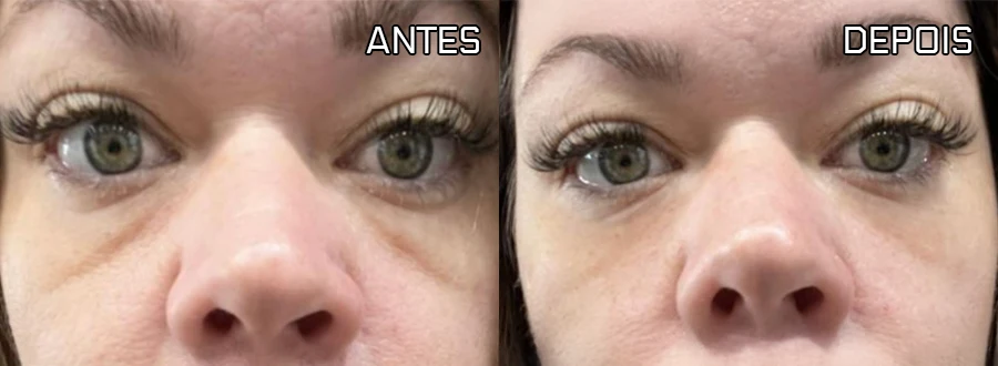 Antes e depois do caso 3
